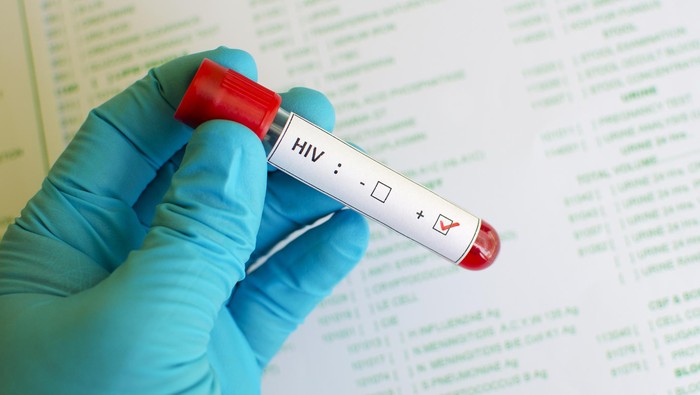 HIV